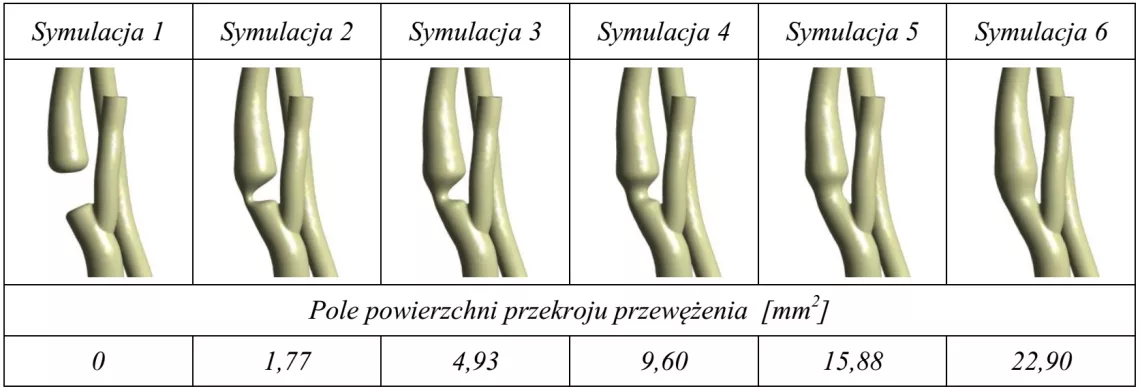 Badania wpływu stopnia otwarcia naczynia na przepływ w kole tętniczym mózgu - wirtualna operacja