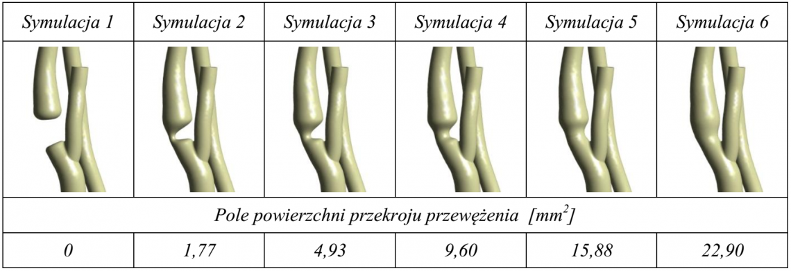 Badania wpływu stopnia otwarcia naczynia na przepływ w kole tętniczym mózgu - wirtualna operacja